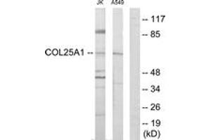Western blot analysis of extracts from Jurkat/A549 cells, using Collagen XXV alpha1 Antibody. (COL25A1 抗体  (AA 101-150))