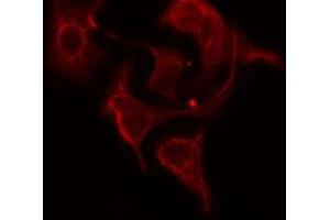 ABIN6274768 staining HepG2 cells by IF/ICC. (RPL12 抗体  (C-Term))