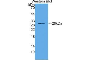 Western blot analysis of the recombinant protein. (HAUS7 抗体  (AA 4-319))