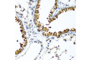 Immunohistochemistry of paraffin-embedded mouse lung using WWTR1 antibody (ABIN5974805) at dilution of 1/200 (40x lens). (WWTR1 抗体)