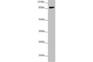 Western blot All lanes: CCHCR1 antibody at 2. (CCHCR1 抗体  (AA 483-782))
