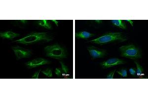 ICC/IF Image Cytokeratin 18 antibody [N2C2], Internal detects Cytokeratin 18 protein at cytoskeleton by immunofluorescent analysis. (Cytokeratin 18 抗体)