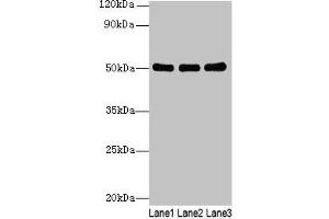 Western blot All lanes: SIGLEC6 antibody at 6 μg/mL Lane 1: Human high value serum Lane 2: A549 whole cell lysate Lane 3: Caco-2 whole cell lysate Secondary Goat polyclonal to rabbit IgG at 1/10000 dilution Predicted band size: 50, 39, 49, 38, 43, 45 kDa Observed band size: 50 kDa (SIGLEC6 抗体  (AA 76-269))