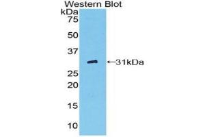 Western blot analysis of the recombinant protein. (Fc gamma RII (CD32) (AA 47-285) 抗体)