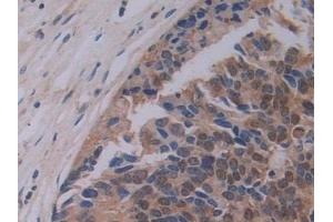 Immunohistochemistry (IHC) image for anti-Phosphatidylethanolamine Binding Protein 1 (PEBP1) (AA 2-187) antibody (ABIN7436330)