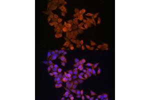 Immunofluorescence analysis of HeLa cells using S100 Rabbit pAb (ABIN6128693, ABIN6147339, ABIN6147340 and ABIN6214636) at dilution of 1:100 (40x lens). (S100A14 抗体  (AA 1-104))