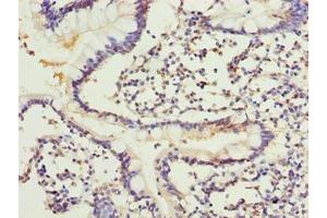 Immunohistochemistry of paraffin-embedded human small intestine tissue using ABIN7143514 at dilution of 1:100 (ARL6IP1 抗体  (AA 93-133))