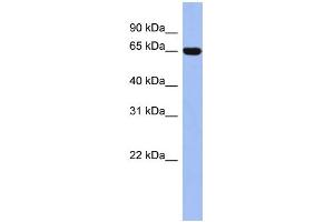 WB Suggested Anti-TRIM47 Antibody Titration:  0. (TRIM47 抗体  (Middle Region))