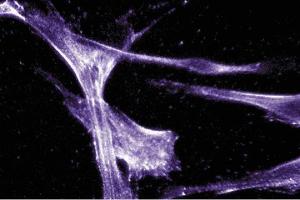 Immunofluorescent staining of Hs68 cells with anti-Actin Ab-5. (Actin 抗体)