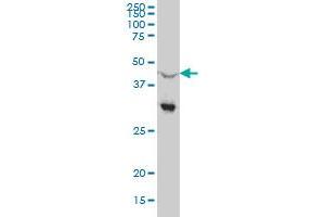 NR0B1 monoclonal antibody (M03A), clone 1F10 Western Blot analysis of NR0B1 expression in Hela S3 NE .
