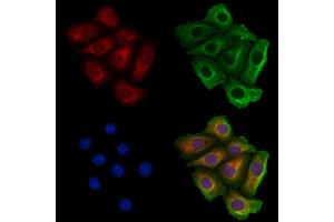 MARS Antibody staining Hela cells by IF/ICC. (Mars (MARS) (Internal Region) 抗体)
