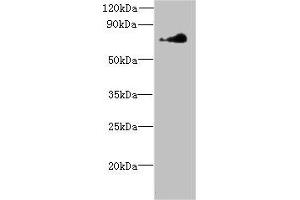 Western blot All lanes: NEK11 antibody at 7 μg/mL + Hela whole cell lysate Secondary Goat polyclonal to rabbit at 1/10000 dilution Predicted band size: 75, 55, 56, 69 kDa Observed band size: 75 kDa (NEK11 抗体  (AA 245-482))