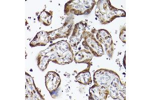 Immunohistochemistry of paraffin-embedded human placenta using UBQLN4 Rabbit pAb (ABIN7271124) at dilution of 1:150 (40x lens). (UBQLN4 抗体  (AA 300-390))