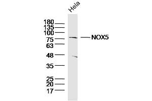 Hela lysates probed with NOX5 Polyclonal Antibody, Unconjugated  at 1:300 dilution and 4˚C overnight incubation. (NOX5 抗体  (AA 501-600))