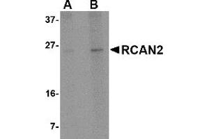 Western Blotting (WB) image for anti-Regulator of Calcineurin 2 (RCAN2) (Middle Region) antibody (ABIN1031056)