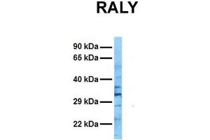 Host:  Rabbit  Target Name:  RALY  Sample Tissue:  Human Ovary Tumor  Antibody Dilution:  1. (Raly 抗体  (N-Term))