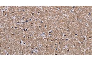 Immunohistochemistry of paraffin-embedded Human brain using MECP2 Polyclonal Antibody at dilution of 1:60 (MECP2 抗体)