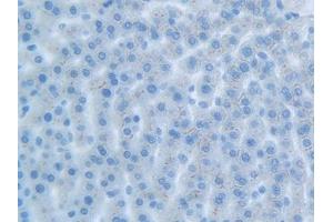 Immunohistochemistry (IHC) image for anti-Carcinoembryonic Antigen-Related Cell Adhesion Molecule 1 (CEACAM1) (AA 36-145) antibody (ABIN7436945)