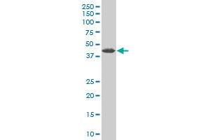 ZNF265 monoclonal antibody (M02), clone 2A11 Western Blot analysis of ZNF265 expression in Jurkat . (ZNF265 抗体  (AA 1-106))