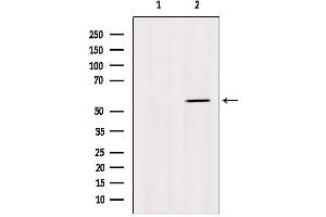 Western blot analysis of extracts from Myeloma cells, using Cytochrome P450 1A2 Antibody. (CYP1A2 抗体  (Internal Region))