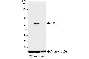 Western Blotting (WB) image for anti-CD5 (CD5) (AA 445-495) antibody (ABIN7454003)