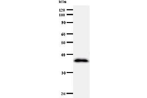 Western Blotting (WB) image for anti-Cyclin F (CCNF) antibody (ABIN931023) (Cyclin F 抗体)