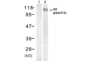 Western blot analysis of extract from DU145 cell, using Androgen Receptor (phospho-Ser213) antibody (E011119). (Androgen Receptor 抗体  (pSer213))