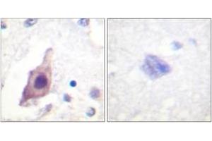 Immunohistochemistry analysis of paraffin-embedded human brain tissue, using CDC25B (Ab-353) Antibody. (CDC25B 抗体  (AA 319-368))