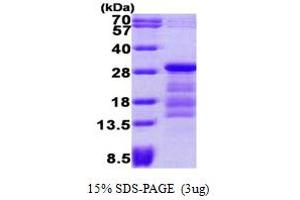 PTTG1 Protein (AA 1-202) (His tag)