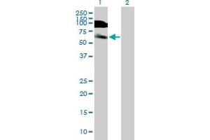 Western Blot analysis of DIDO1 expression in transfected 293T cell line by DIDO1 MaxPab polyclonal antibody. (DIDO1 抗体  (AA 1-544))