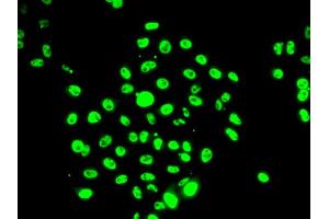 Immunofluorescence analysis of U2OS cells using EFTUD2 antibody (ABIN5974236). (EFTUD2 抗体)