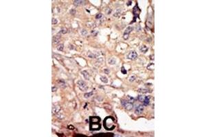 Immunohistochemistry (Paraffin-embedded Sections) (IHC (p)) image for anti-NUAK Family, SNF1-Like Kinase, 1 (NUAK1) (AA 1-30), (N-Term) antibody (ABIN392639)