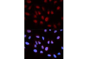 Immunofluorescence (IF) image for anti-5-Aminoimidazole-4-Carboxamide Ribonucleotide Formyltransferase/IMP Cyclohydrolase (ATIC) antibody (ABIN1876739)