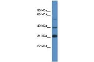 Image no. 1 for anti-SRY (Sex Determining Region Y)-Box 1 (SOX1) (AA 313-362) antibody (ABIN6746081) (SOX1 抗体  (AA 313-362))