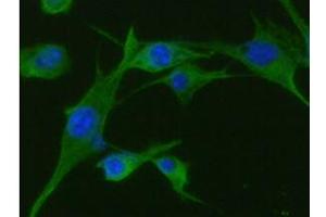 ICC/IF analysis of TPMT in U87MG cells line, stained with DAPI (Blue) for nucleus staining and monoclonal anti-human TPMT antibody (1:100) with goat anti-mouse IgG-Alexa fluor 488 conjugate (Green). (TPMT 抗体  (AA 1-245))