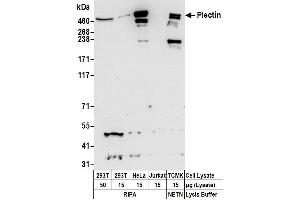 anti-Plectin (PLEC) (AA 4534-4684) antibody