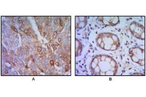 Immunohistochemistry (IHC) image for anti-Suppression of Tumorigenicity 13 (ST13) antibody (ABIN1845122) (HSC70 Interacting Protein HIP 抗体)