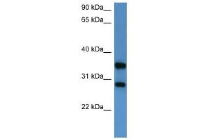 Western Blot showing STYXL1 antibody used at a concentration of 1-2 ug/ml to detect its target protein.