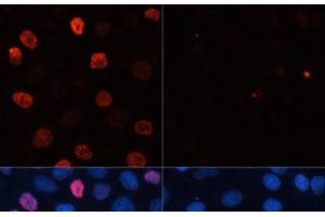 Immunofluorescence analysis of HeLa cells using Phospho-γH2A. (gamma H2AX 抗体  (pSer139))