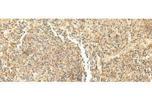 Immunohistochemistry of paraffin-embedded Human tonsil tissue using DHFR Polyclonal Antibody at dilution of 1:50(x200) (Dihydrofolate Reductase 抗体)