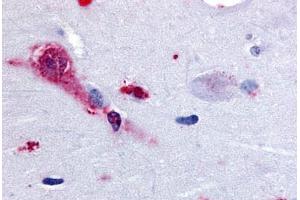 Human Brain, Amygdala (formalin-fixed, paraffin-embedded) stained with TAAR1 antibody ABIN213367 at 28 ug/ml followed by biotinylated goat anti-rabbit IgG secondary antibody ABIN481713, alkaline phosphatase-streptavidin and chromogen. (TAAR1 抗体  (Cytoplasmic Domain))
