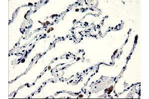 Immunohistochemical staining of paraffin-embedded Human lung tissue using anti-CENPH mouse monoclonal antibody. (CENPH 抗体)