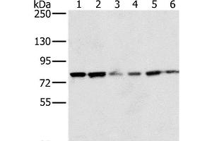 Western Blot analysis of 293T and hela cell, Human testis tissue, skov3, Raji and Jurkat cell using NOX5 Polyclonal Antibody at dilution of 1:200 (NOX5 抗体)