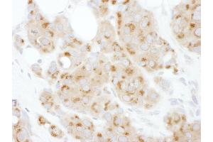 Immunohistochemistry (IHC) image for anti-Activating Transcription Factor 6 (ATF6) (AA 620-670) antibody (ABIN7454954)