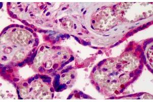 Human Placenta: Formalin-Fixed, Paraffin-Embedded (FFPE) (XPO1 抗体  (AA 390-408))