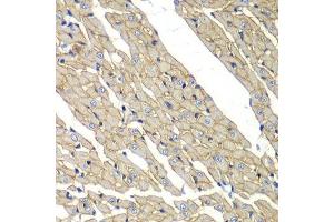 Immunohistochemistry of paraffin-embedded rat heart using SGCD antibody. (SGCD 抗体  (AA 61-290))