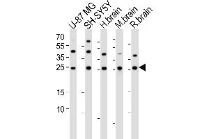 Western blot analysis of lysates from U-87 MG, SH-SY5Y cell line, human brain, mouse brain, rat brain tissue lysate (from left to right), using STMN2 Antibody (N-term) (ABIN6243305 and ABIN6577588). (STMN2 抗体  (N-Term))