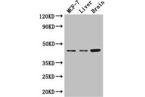 Western Blot Positive WB detected in: MCF-7 whole cell lysate, Mouse liver tissue, Mouse brain tissue All lanes: KCNJ11 antibody at 3 μg/mL Secondary Goat polyclonal to rabbit IgG at 1/50000 dilution Predicted band size: 44, 34 kDa Observed band size: 44 kDa (KCNJ11 抗体  (AA 172-390))