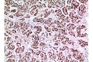 Immunohistochemistry (IHC) image for anti-Kruppel-Like Factor 13 (KLF13) antibody (ABIN3187843)