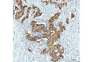 IHC analysis of XTP3TPA/DCTPP1 using anti-XTP3TPA/DCTPP1 antibody (ABIN7600677).
